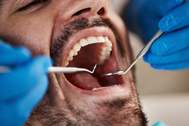 Best Emergency Dental Care for Broken or Chipped Teeth in Meeker, OK